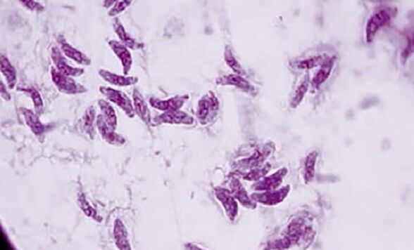 ปรสิตโปรโตซัว toxoplasma gondii สาเหตุของโรคท็อกโซพลาสโมซิส